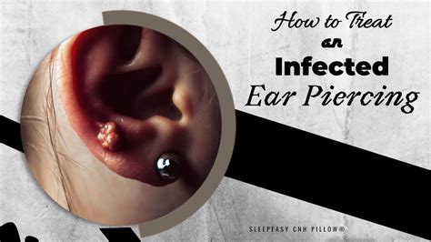 How to treat an infected piercing